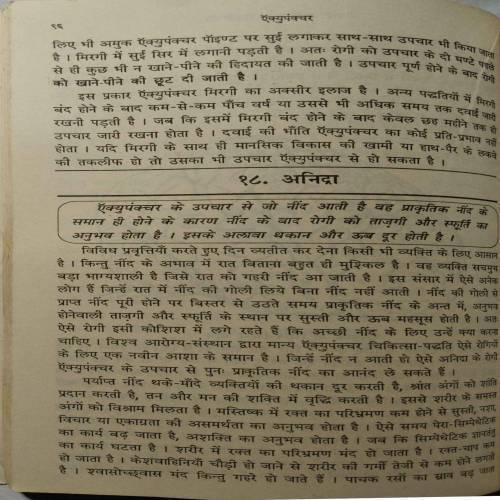 Bina Dawai Rog Mitayen : Accupuncture